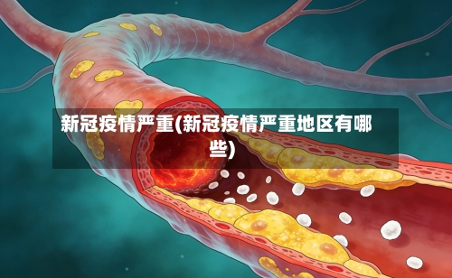 新冠疫情严重(新冠疫情严重地区有哪些)-第3张图片