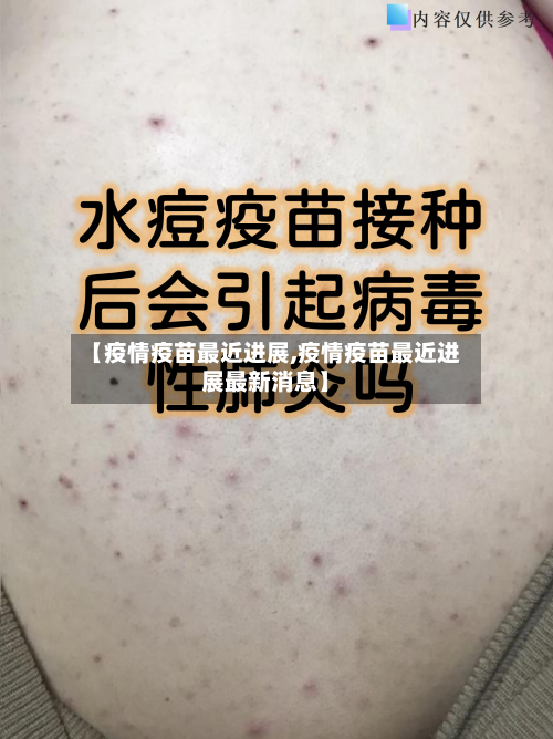 【疫情疫苗最近进展,疫情疫苗最近进展最新消息】-第2张图片