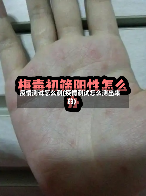 疫情测试怎么测(疫情测试怎么测出来的)-第3张图片