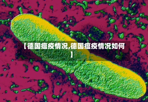 【德国瘟疫情况,德国瘟疫情况如何】-第2张图片